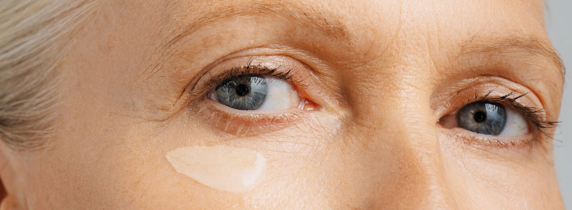 Patas de gallo en la cara: Qué son y cómo tratarlas Patas de gallo en la cara: Qué son y cómo tratarlas